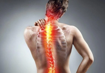 اسکولیوز یا انحراف ستون فقرات چگونه بروز می‌کند و چه نشانه‌هایی دارد؟