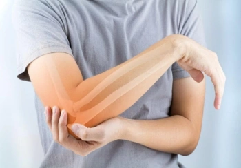 پوکی استخوان از تشخیص تا درمان