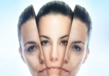 هرآنچه باید درباره مزوتراپی و بوتاکس بدانید