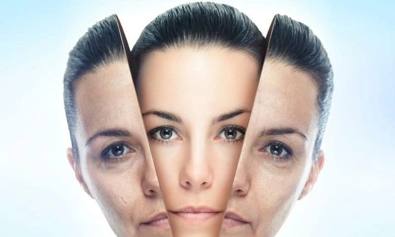 هرآنچه باید درباره مزوتراپی و بوتاکس بدانید