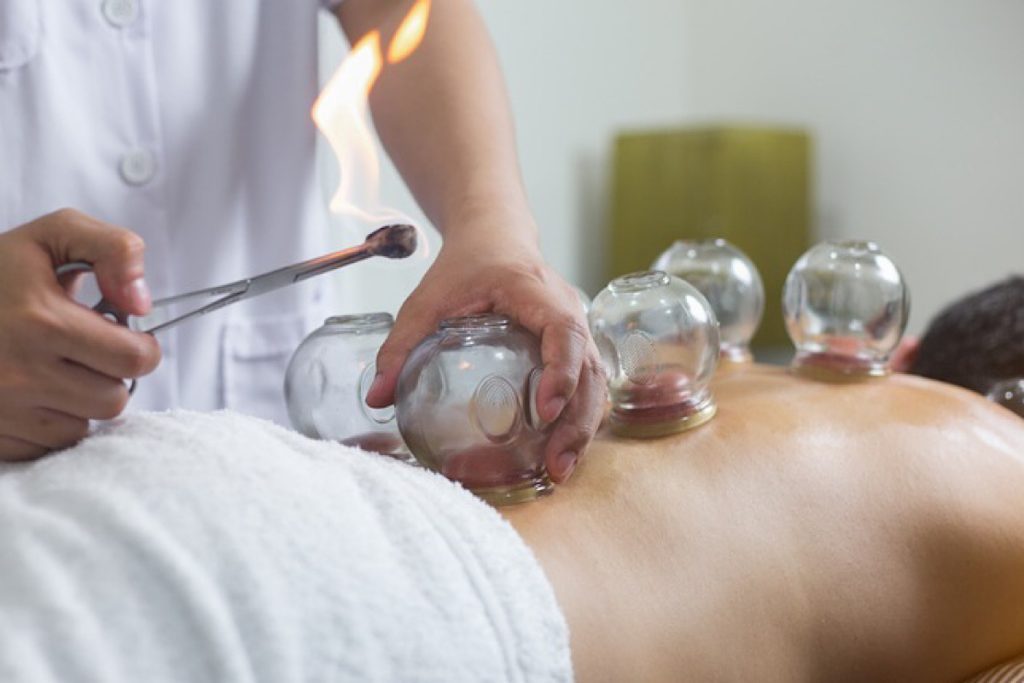 مراقبت‌ های قبل و بعد از حجامت چیست؟3