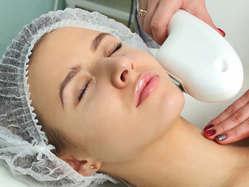 مزایای لیزر مو های زائد1