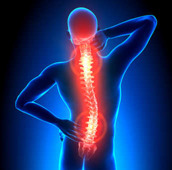 تنگی کانال نخاعی5