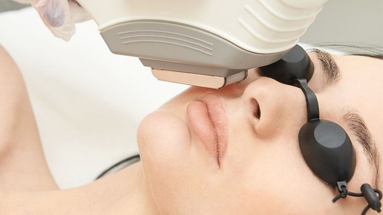 مزایای لیزر مو های زائد6