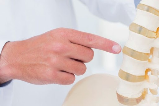 فیزیوتراپی کمر؛ درمان بدون جراحی