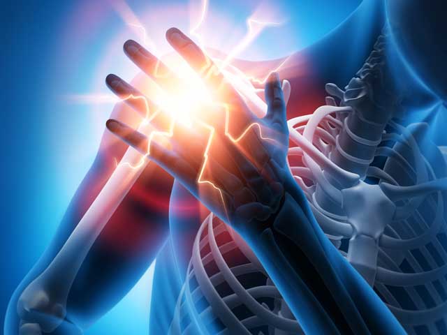 فیزیوتراپی