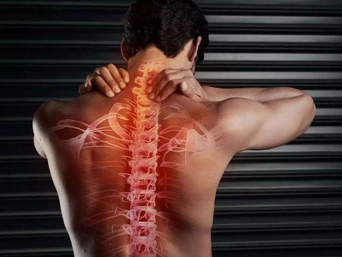 تنگی کانال نخاعی3