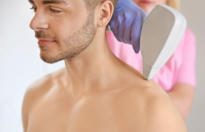 مزایای لیزر مو های زائد2